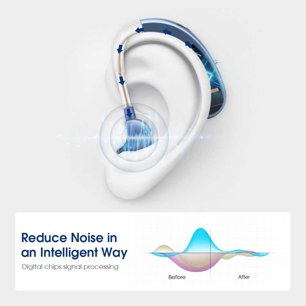 TaffOmicron Alat Bantu Dengar Hearing Aid Adjustable Rechargeable - JZ-1088F8