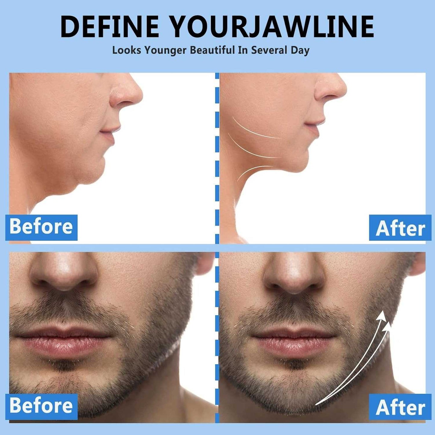 ILAMVIE Alat Latihan Rahang Silicone Jaw Trainer Mastic Ball 2 PCS - LV-32