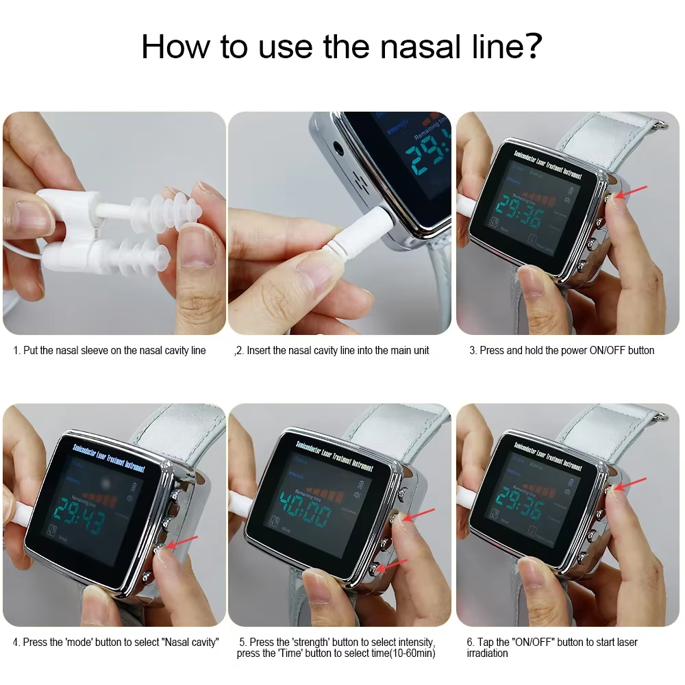 OPSLEA Jam Tangan Terapi Nano Laser Therapy Watch 13 Hole 650nm - CD-802A