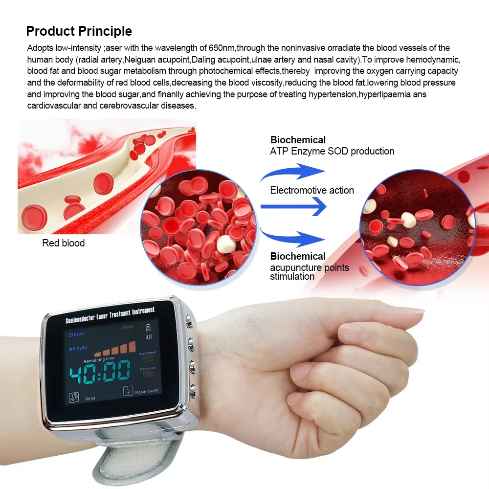 OPSLEA Jam Tangan Terapi Nano Laser Therapy Watch 13 Hole 650nm - CD-802A