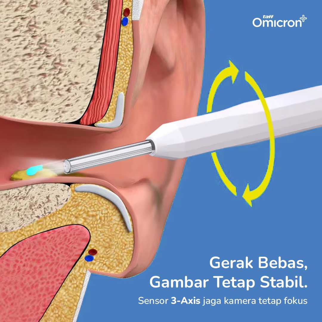 TaffOmicron Kamera Endoskopi Pembersih Telinga Endoscope HD WiFi - NE6