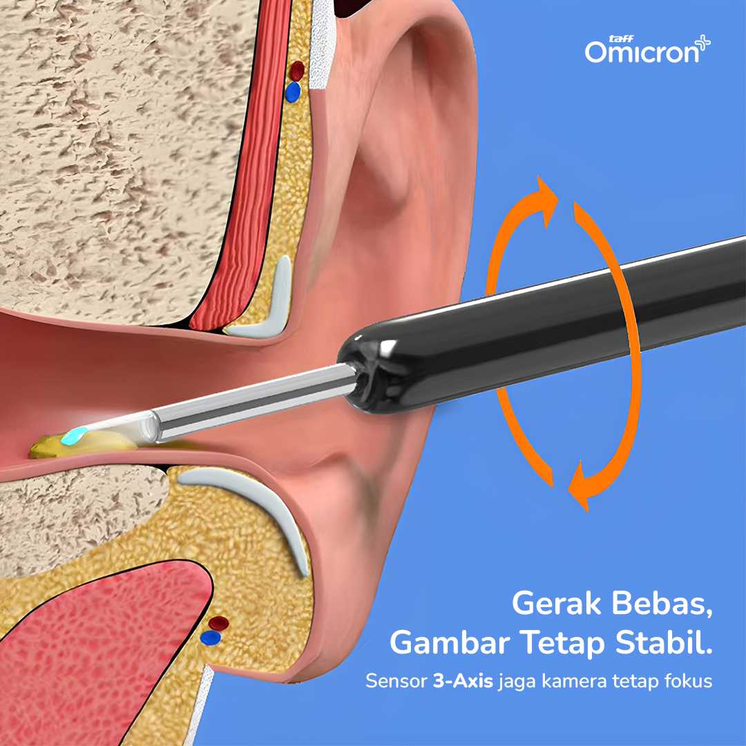 TaffOmicron Kamera Endoskopi Pembersih Telinga Endoscope Wireless - NE3