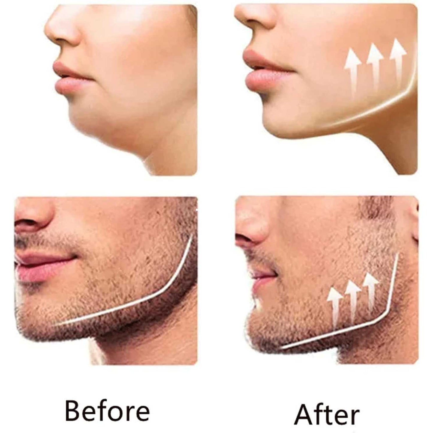 TIMOTRAS Alat Latihan Rahang Silicone Mewing Jaw Trainer Ball 2 PCS - TM734