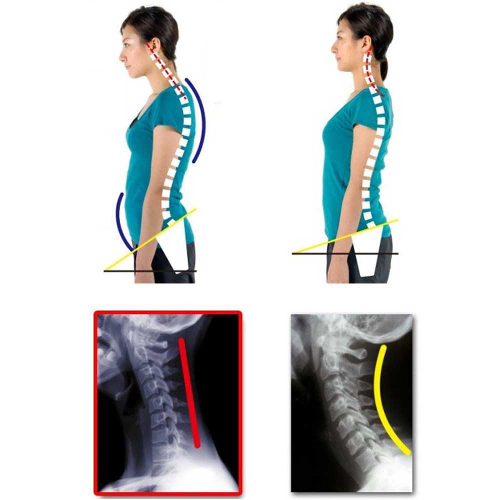 TMISHION Tali Korektor Postur Punggung Back Body Harness - BBJ-17