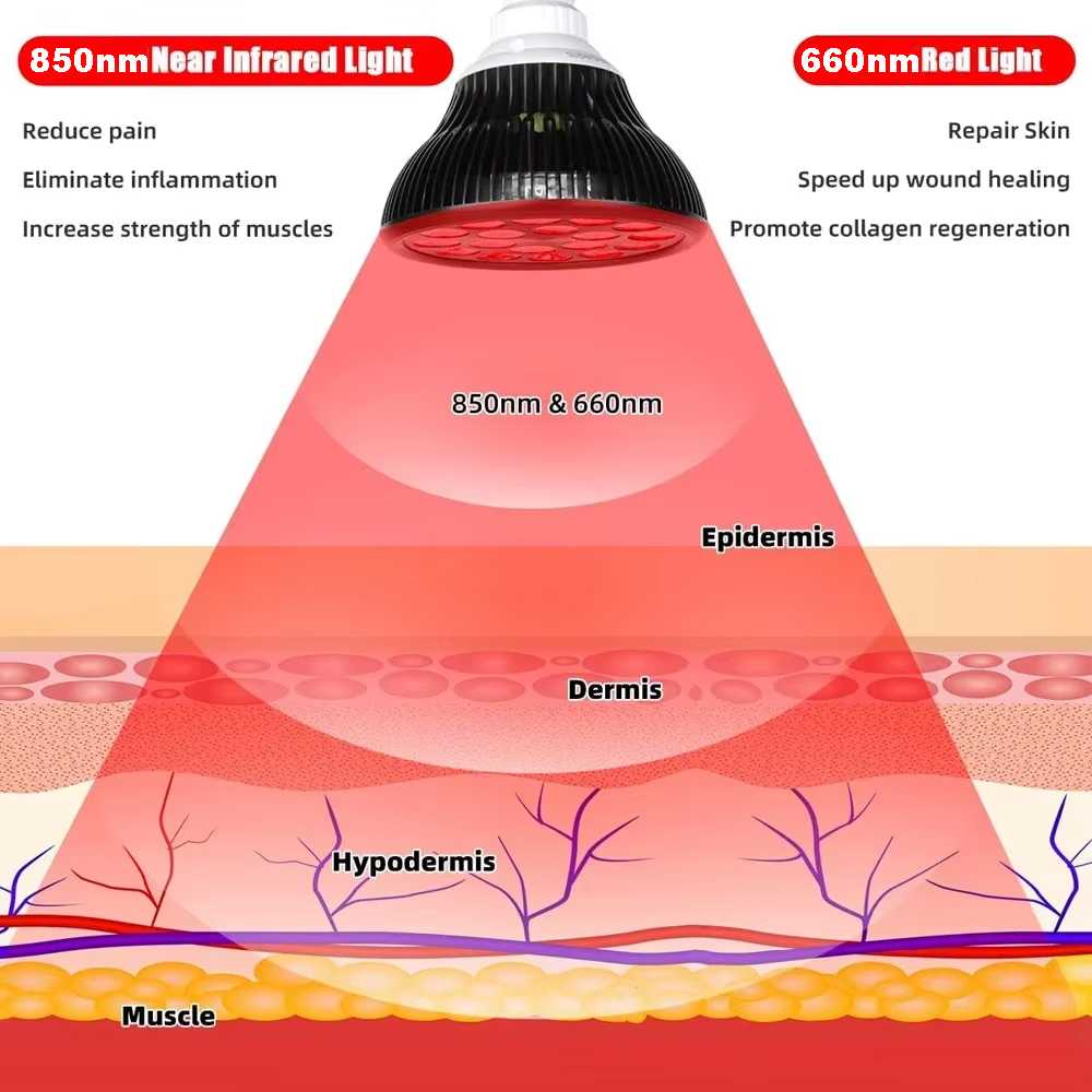 ZONGKUNG Lampu Terapi Infrared PAR38 Physiotherapy Lamp 850nm 54W - NC54